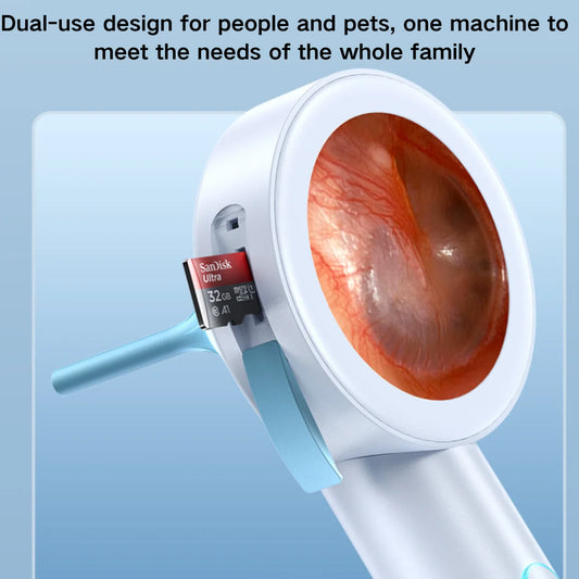 HD Visual Ear Camera Otoscope with 1.8'' Screen – For Kids, Adults & Pets